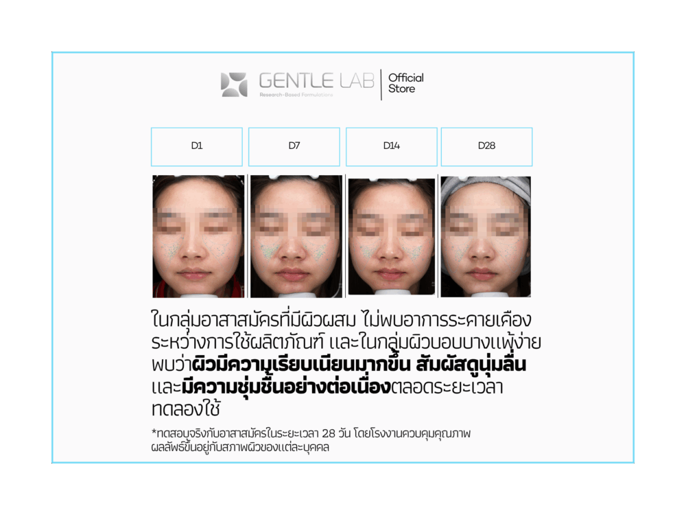 Anti-Acne and Clarity Set - Image 3