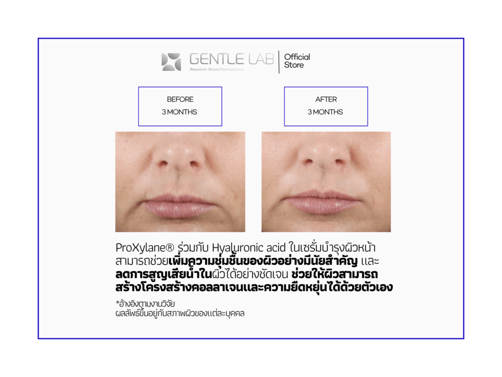 Brightening & Antioxidant Defense Set - Image 4